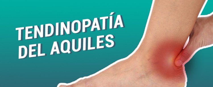Tendinopatía del Aquiles